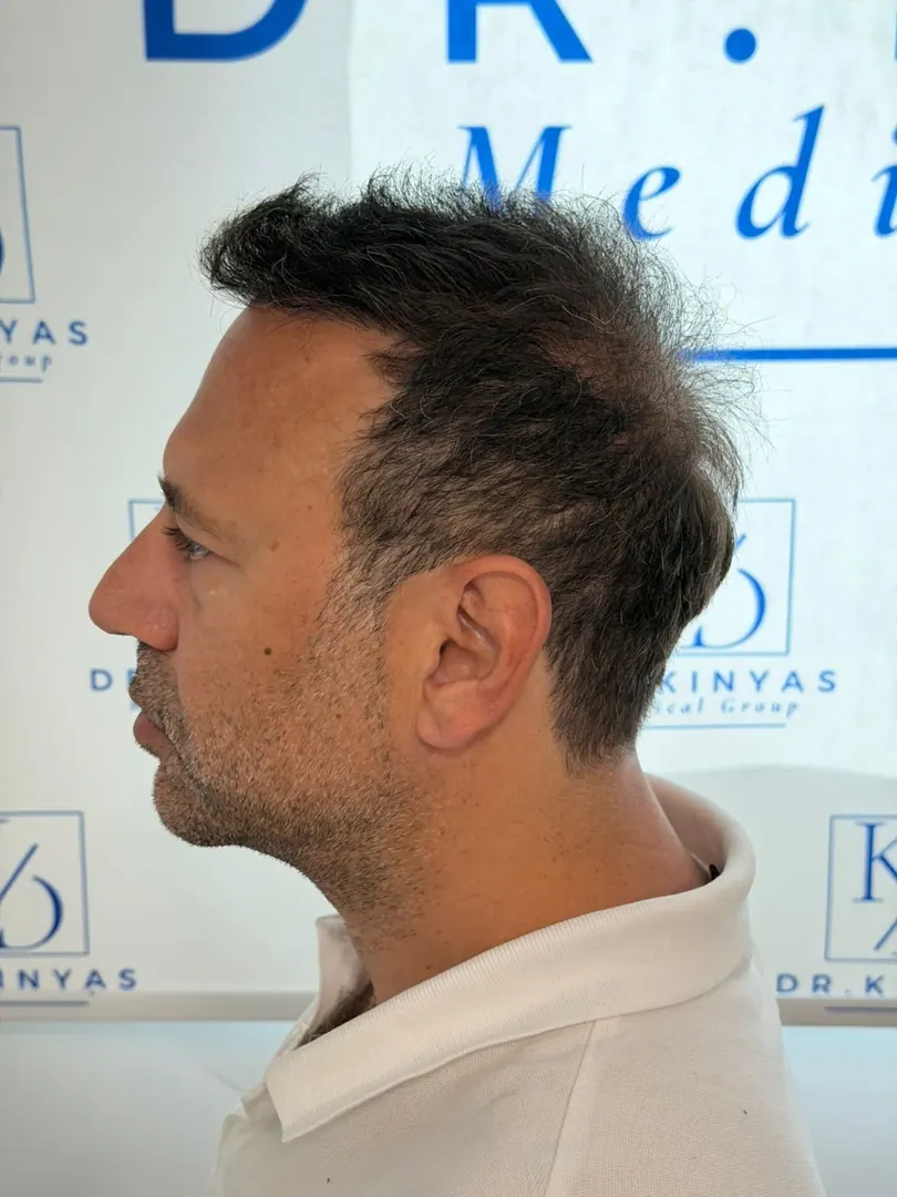 Hasta 70 · 2