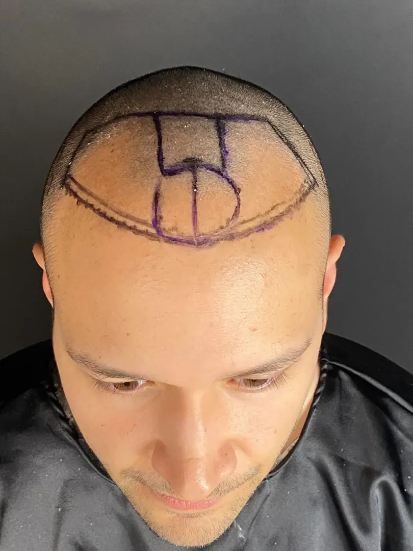 Hasta 63 · 4