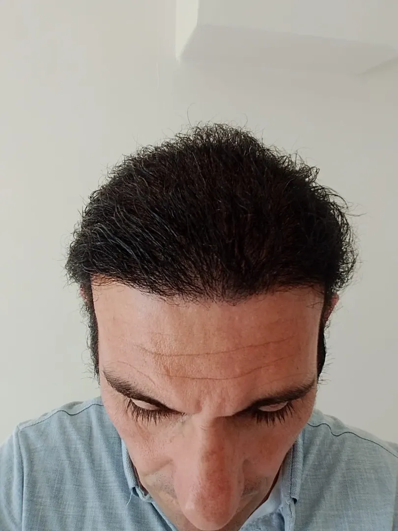 Hasta 59 · 2