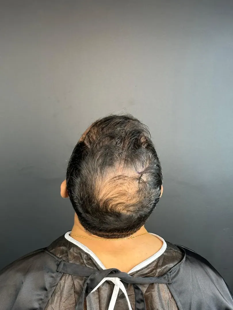 Patient 54 · 2