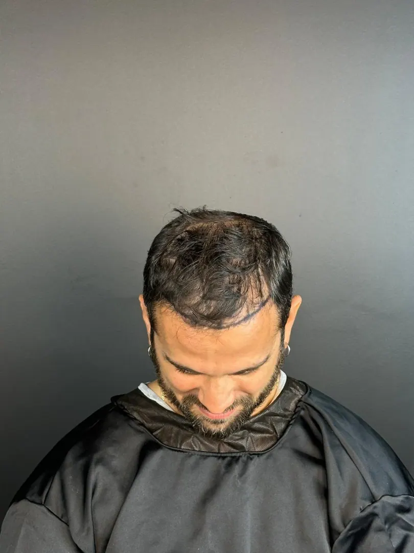 Patient 54 · 3