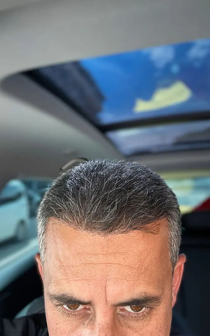 Hasta 98 · 2