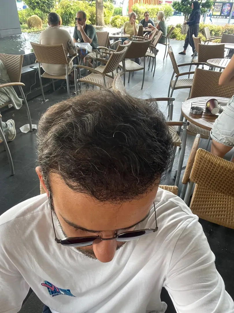 Hasta 41 · 2
