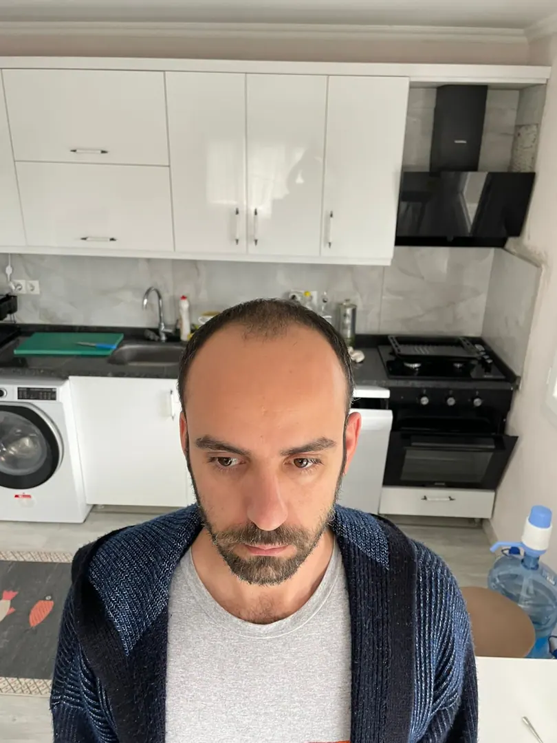 Hasta 41 · 4