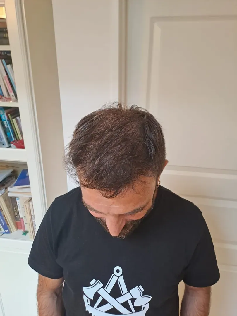 Hasta 38 · 5