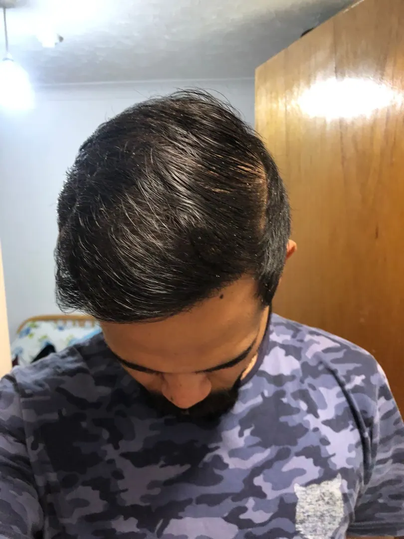 Hasta 34 · 3