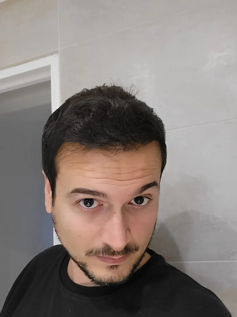 Hasta 33 · 18