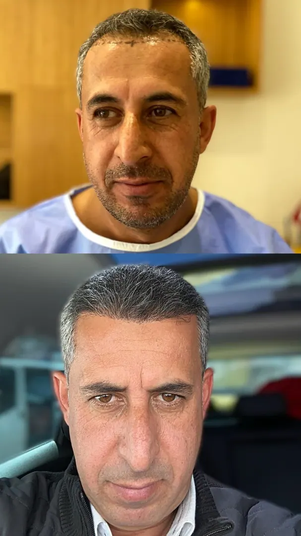 Hasta 32 · 2