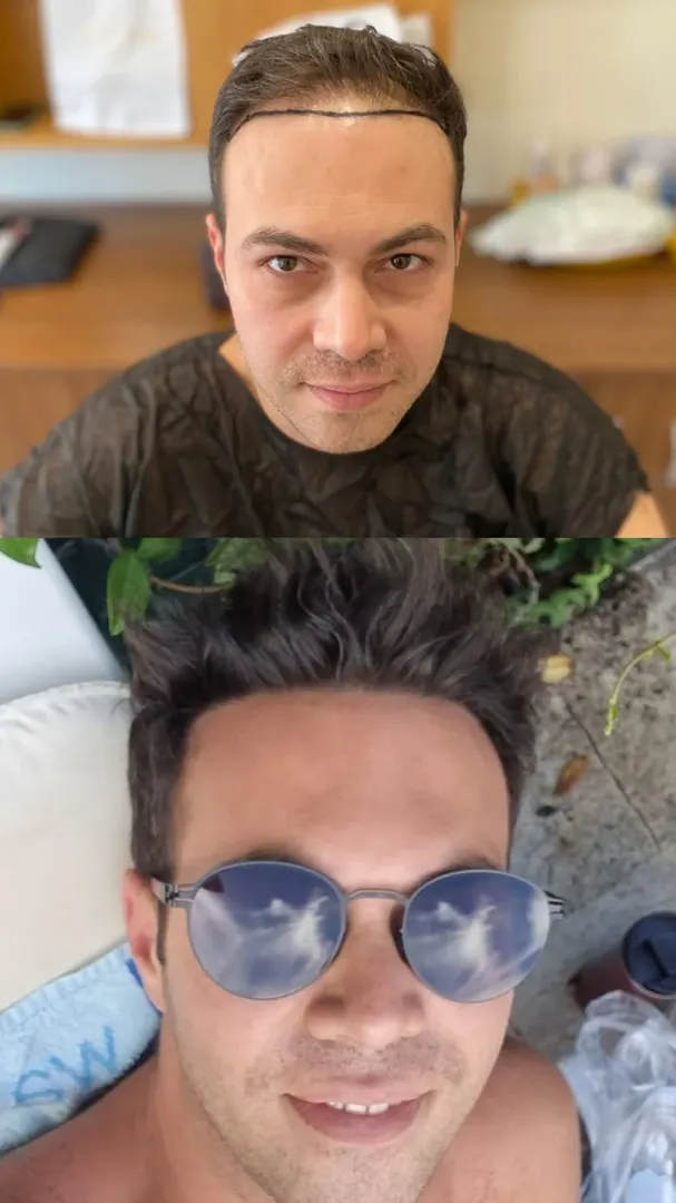 Hasta 94 · 3