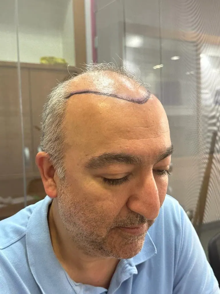 Hasta 13 · 17