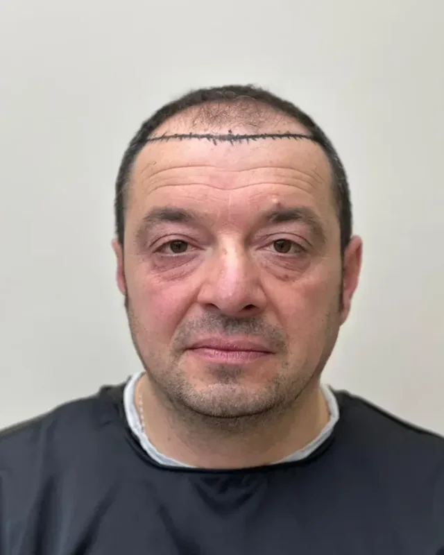 ÖNCESİ