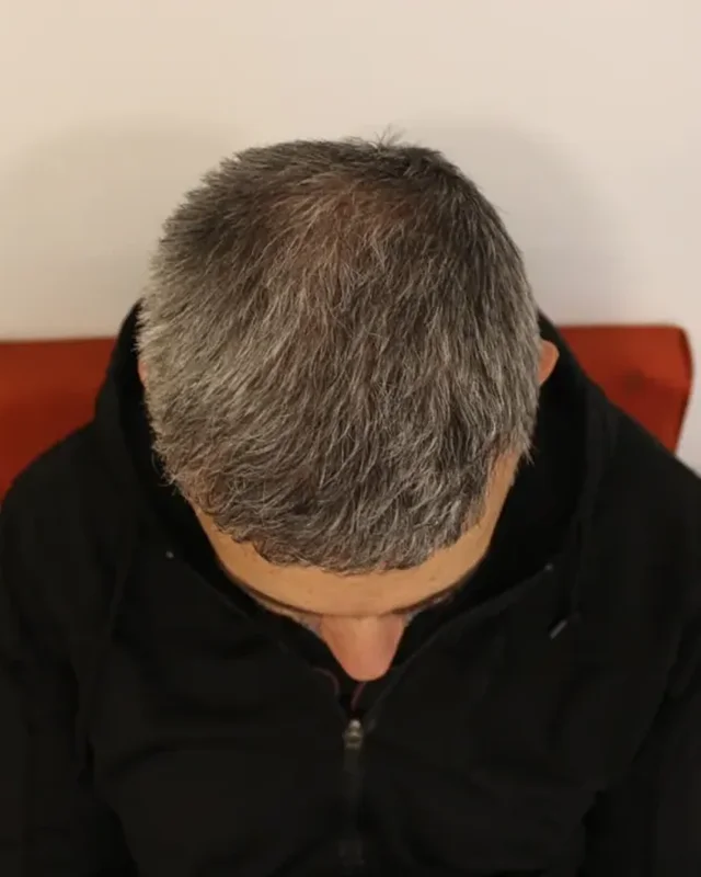 SONRASI