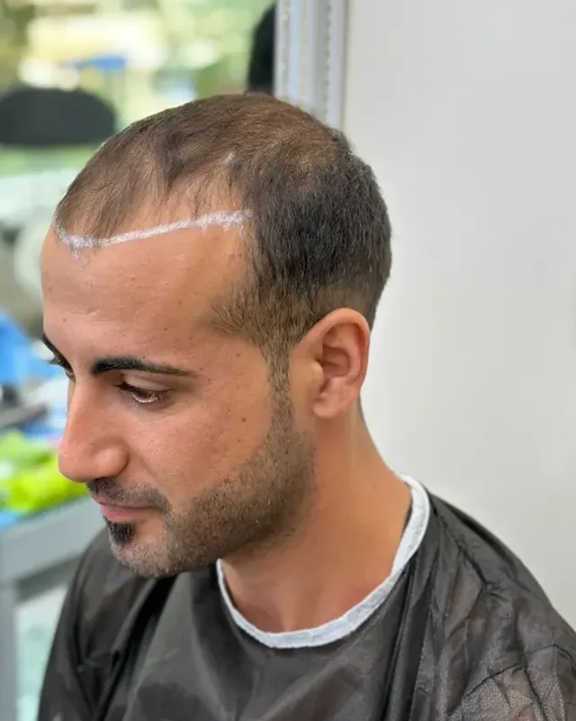 ÖNCESİ