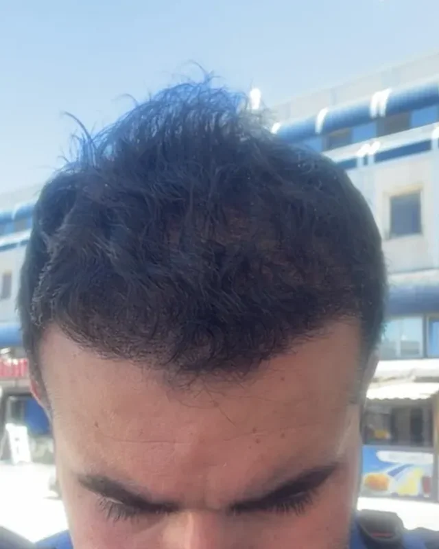 SONRASI
