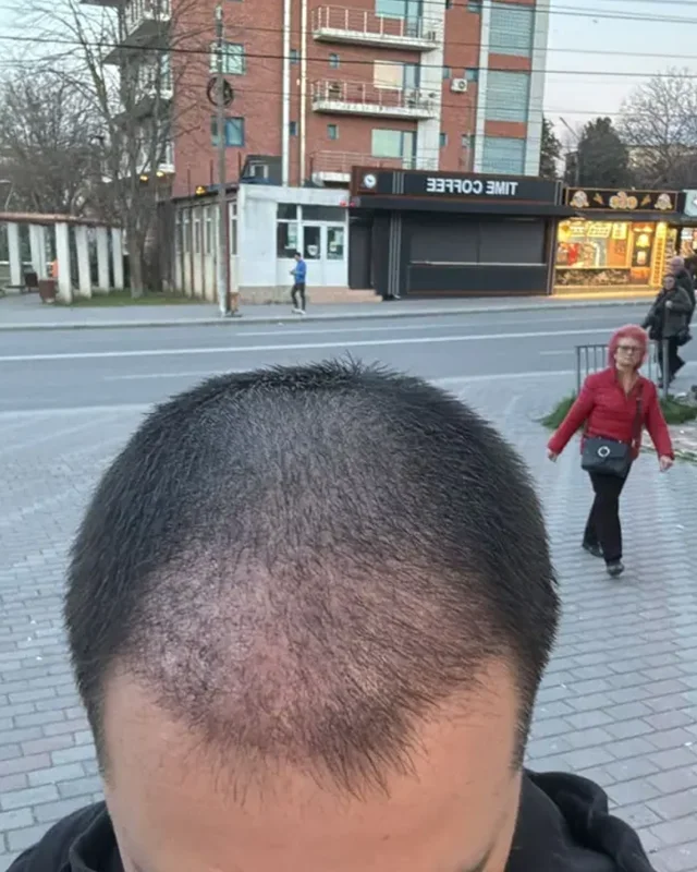 ÖNCESİ