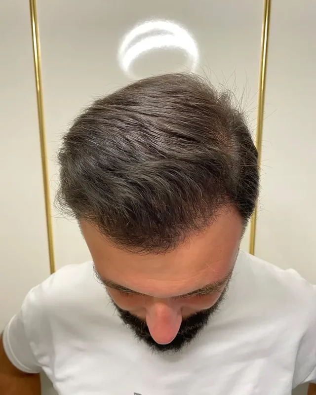 SONRASI