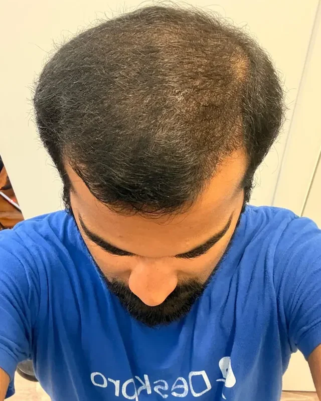 SONRASI