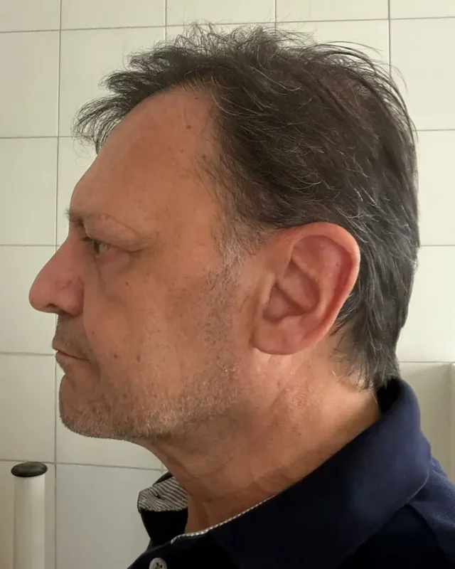 SONRASI