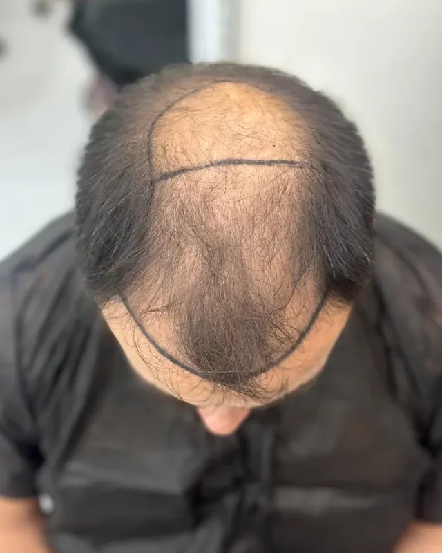 ÖNCESİ