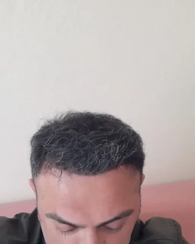 SONRASI