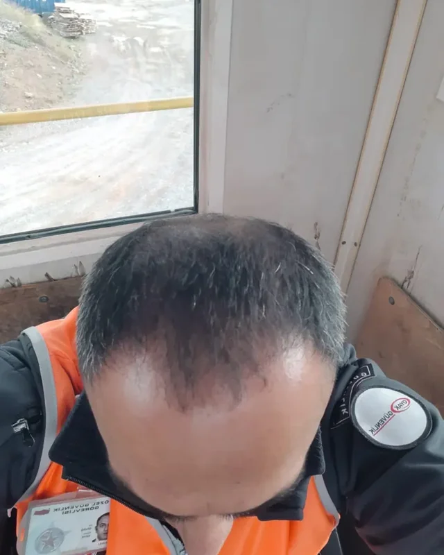 ÖNCESİ