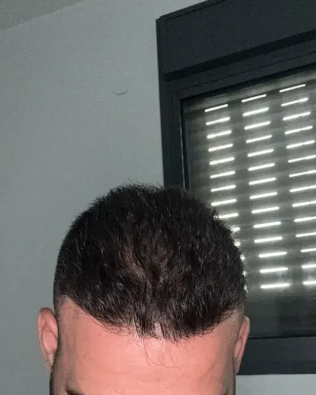 SONRASI