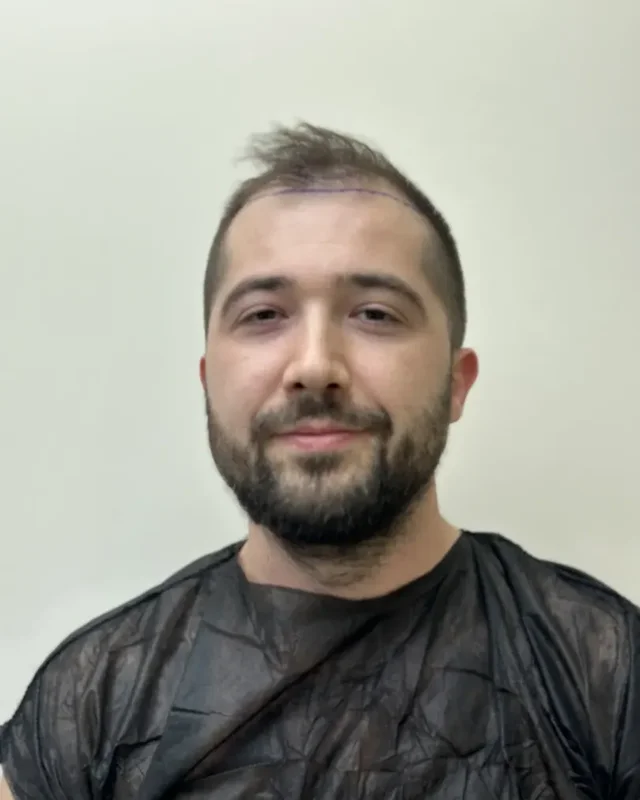 ÖNCESİ