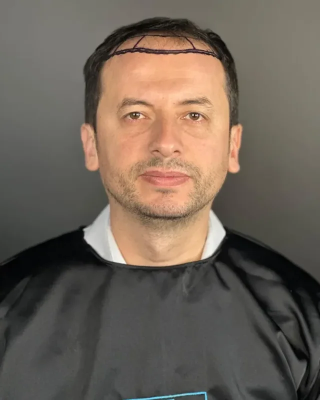ÖNCESİ
