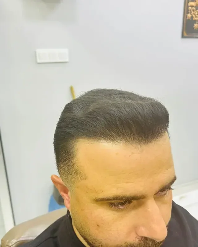SONRASI