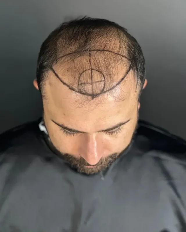 ÖNCESİ