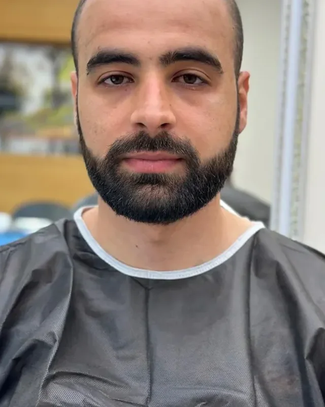 ÖNCESİ