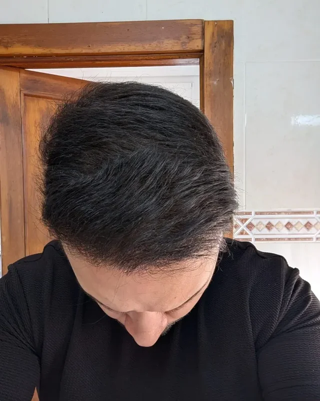 SONRASI