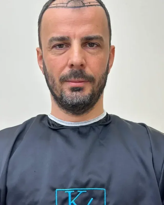 ÖNCESİ
