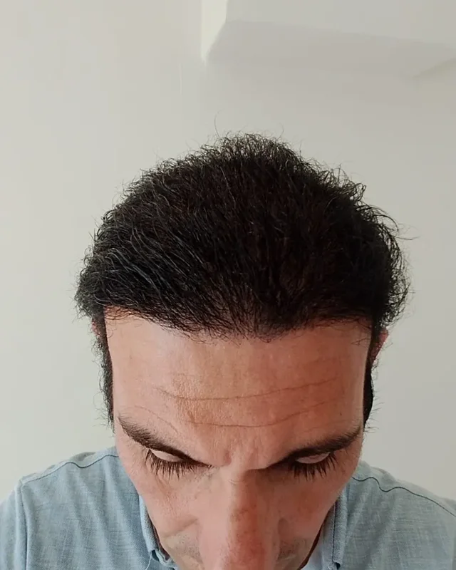 SONRASI