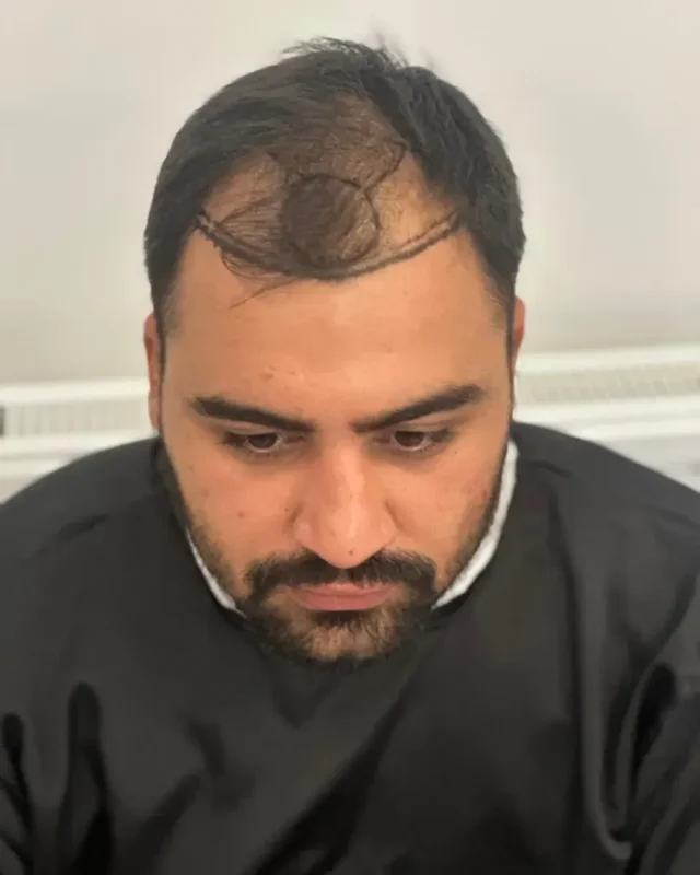 ÖNCESİ