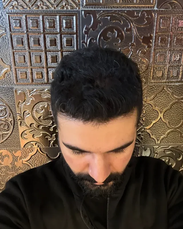 SONRASI