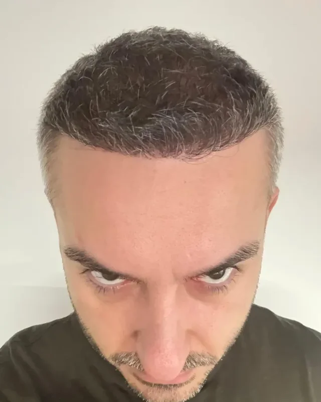 SONRASI