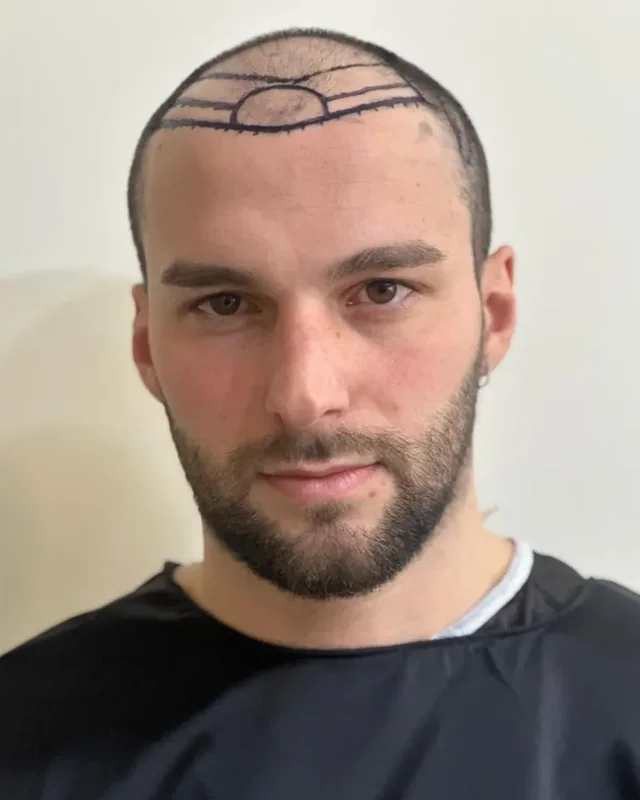 ÖNCESİ