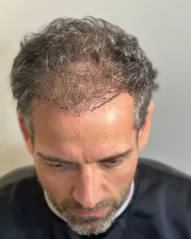 ÖNCESİ