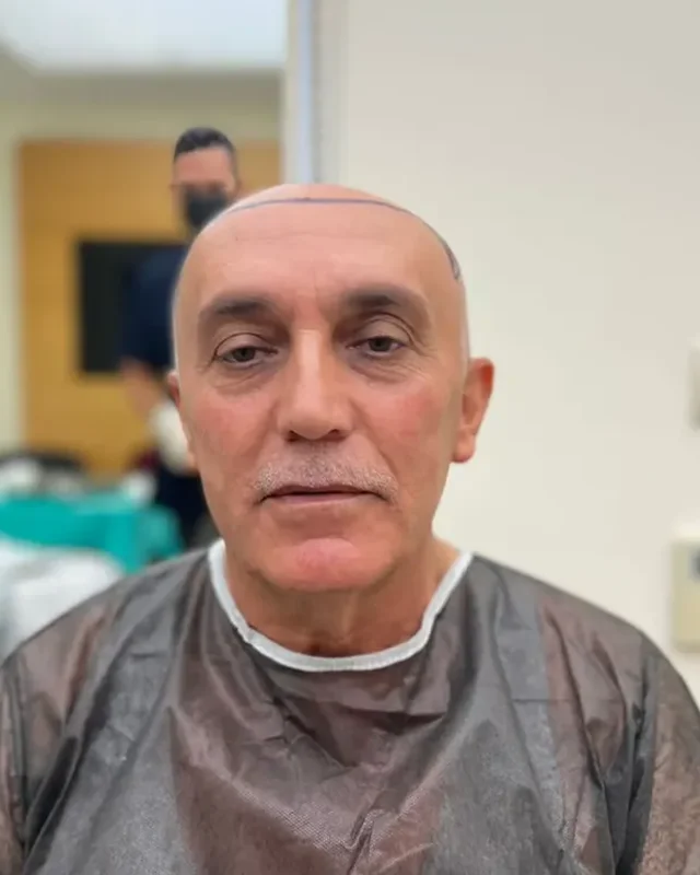 ÖNCESİ