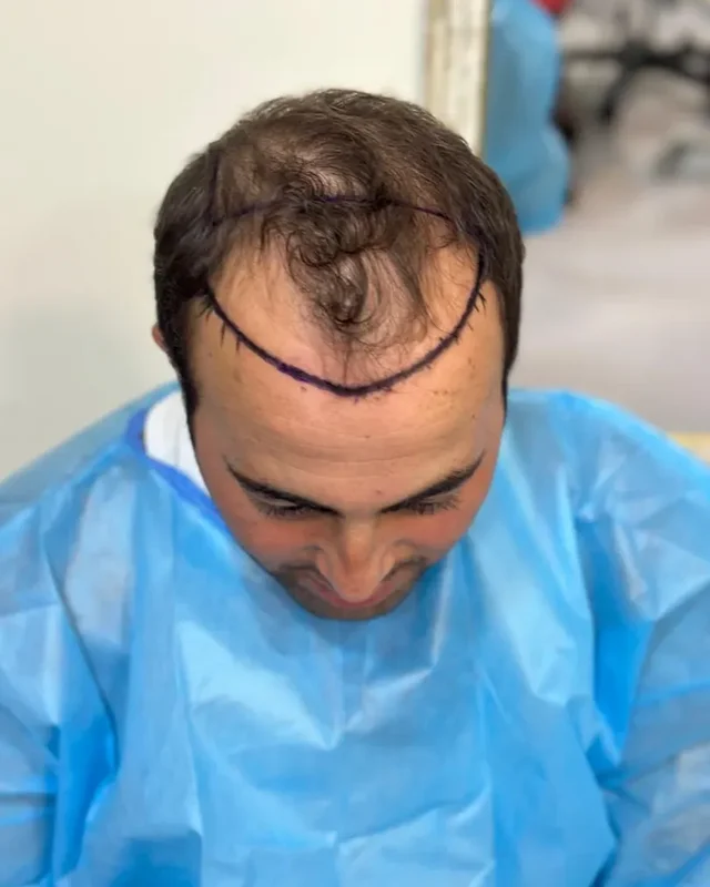 ÖNCESİ