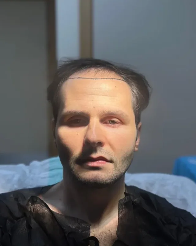 ÖNCESİ