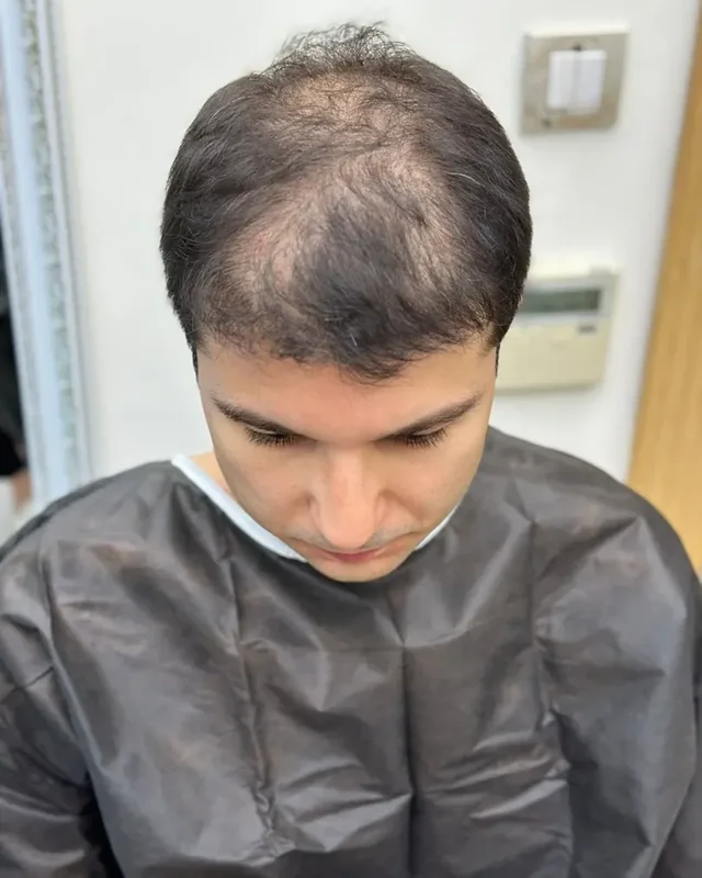 ÖNCESİ