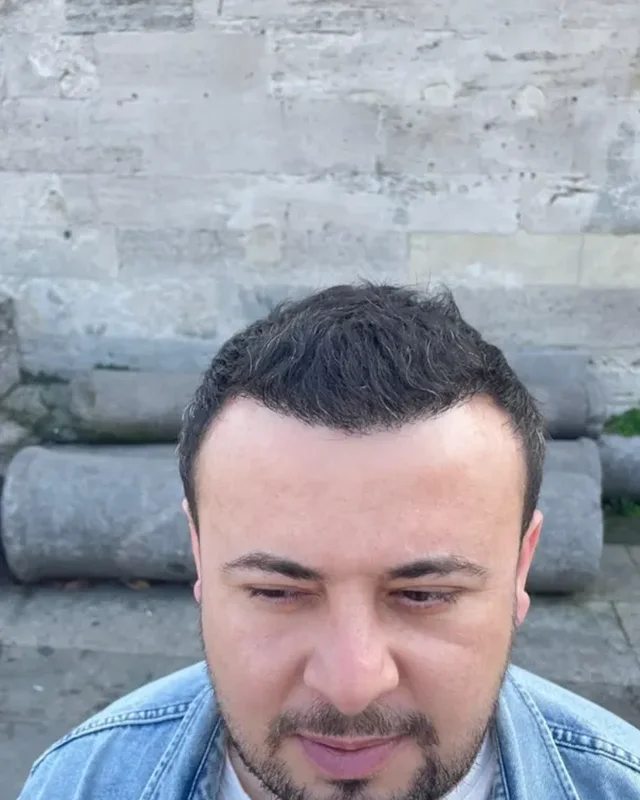 SONRASI