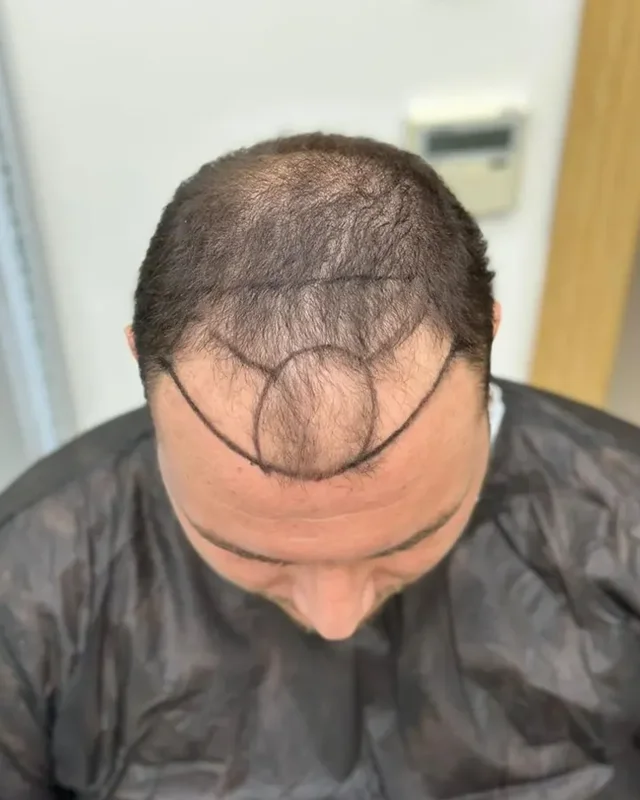 ÖNCESİ
