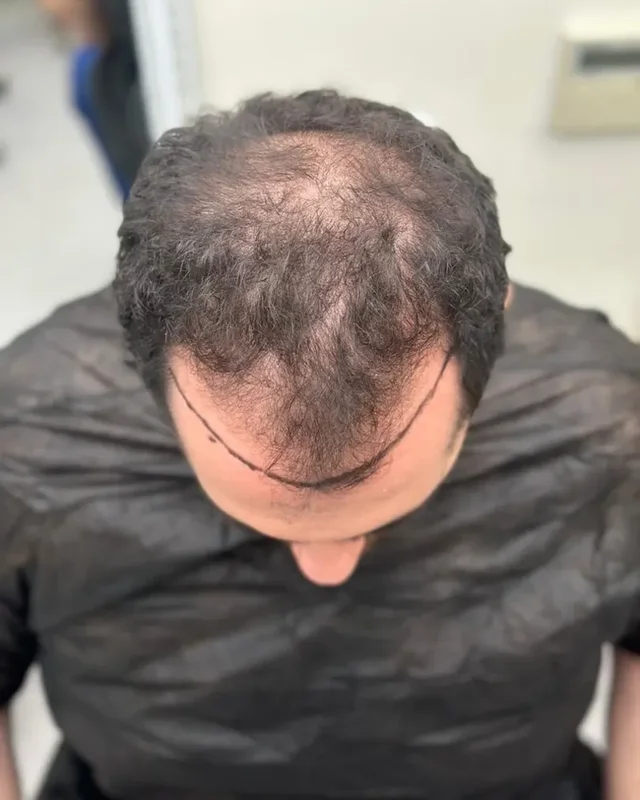 ÖNCESİ