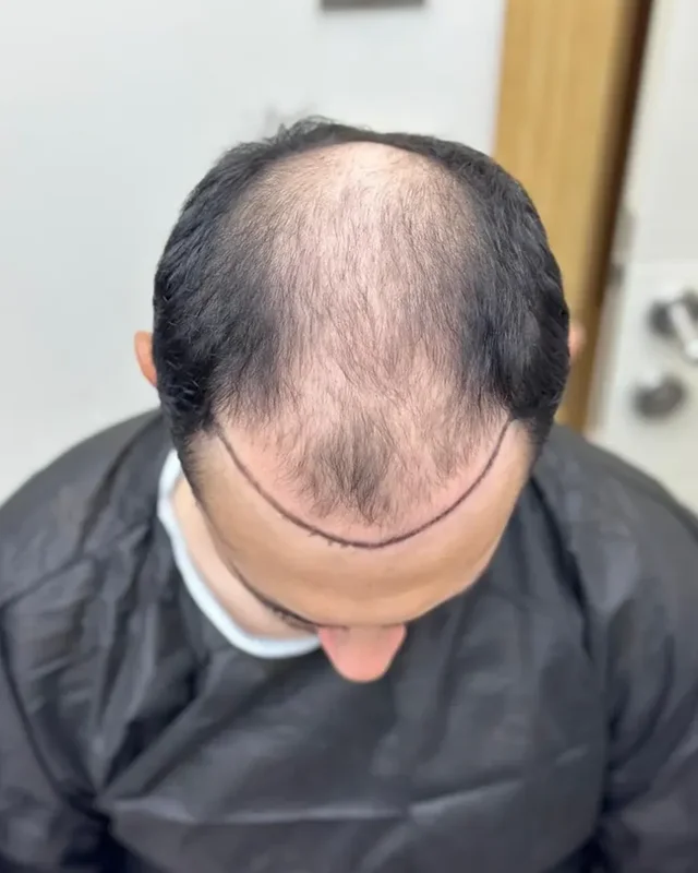 ÖNCESİ