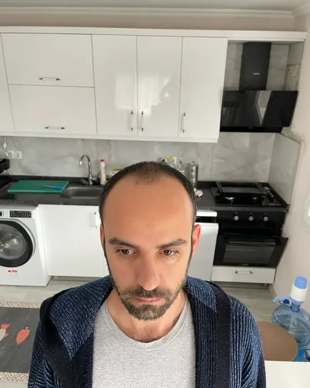 ÖNCESİ