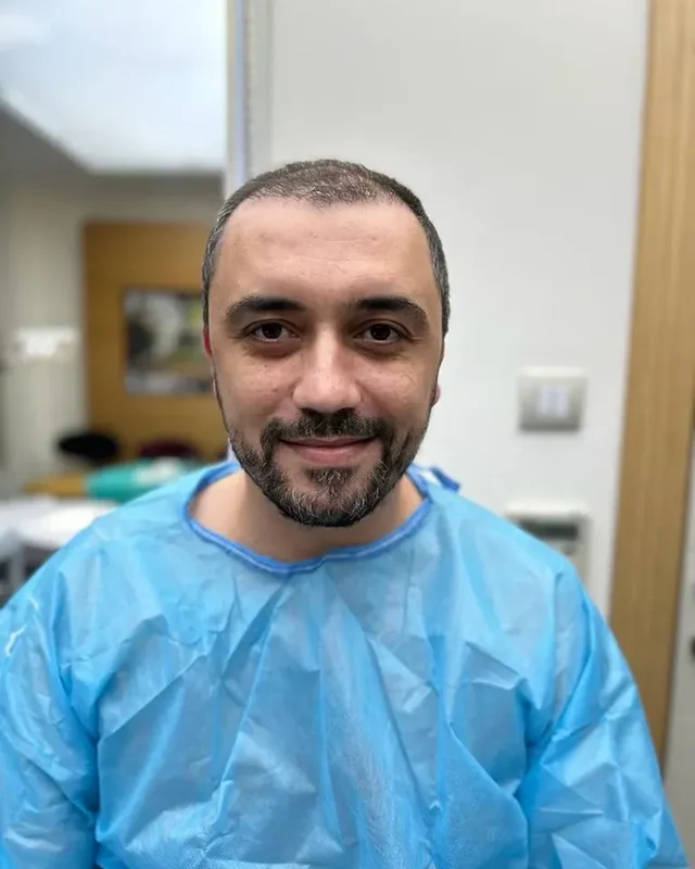 ÖNCESİ