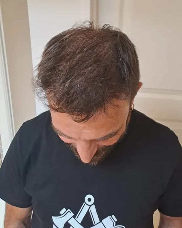 SONRASI
